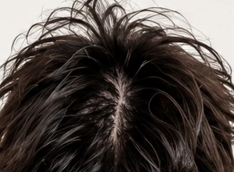 Close-up of frizzy, unruly men's hair